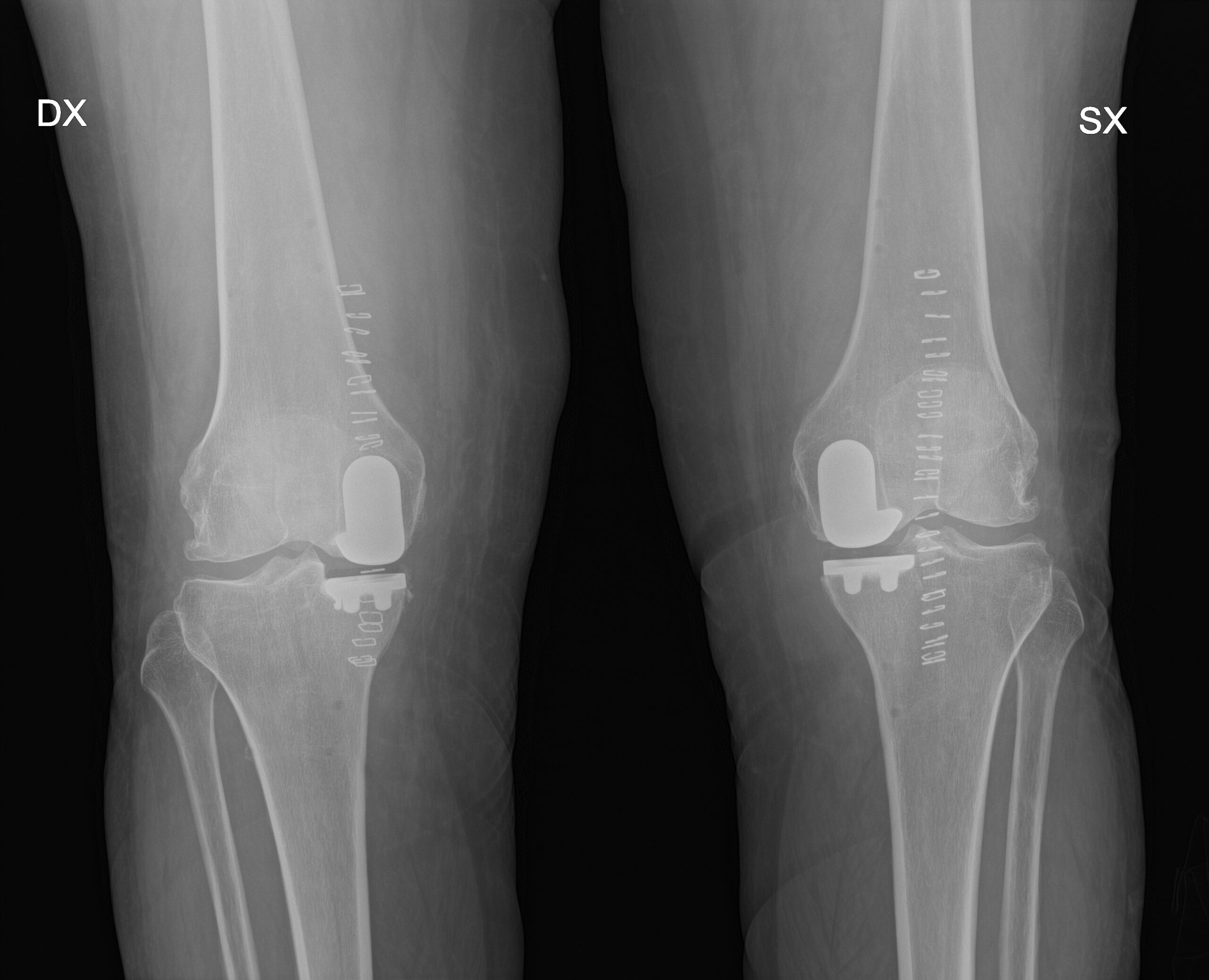 1.2.410.200049.2.48625006897842.3.1.20220202163128236.36022-f1